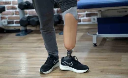 Kahramanmaraş Felaketinde Bacak Kaybeden Murat Akkoç, Yeni Proteziyle Yürüyebiliyor